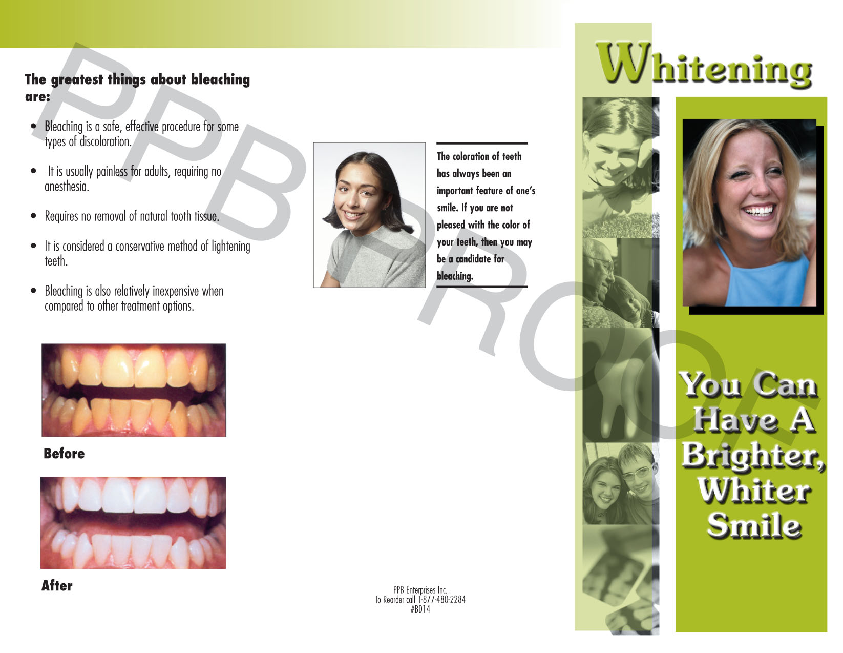 Whitening - Click Image to Close